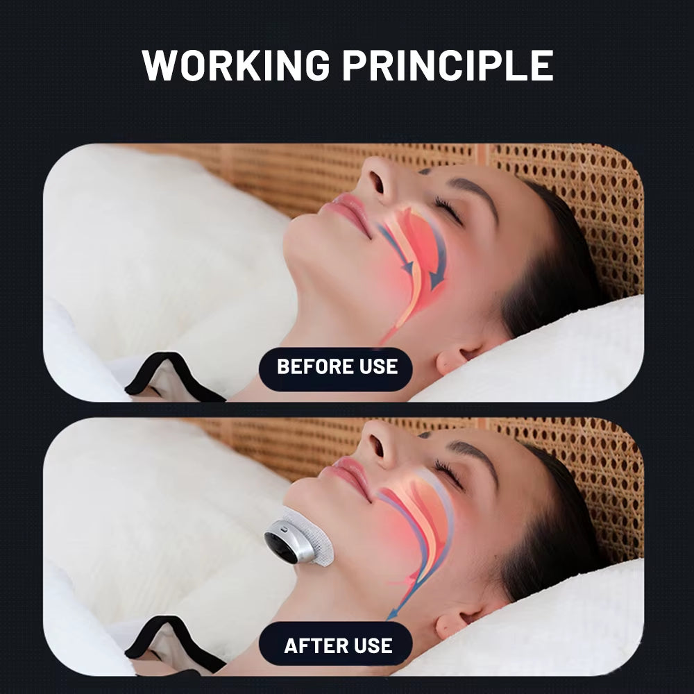 Products​SmartSnore™ 5-Pair EMS Anti-Snoring Device – Breathe Easy, Sleep Deep -Smartshelf Sales Smartshelf Sales